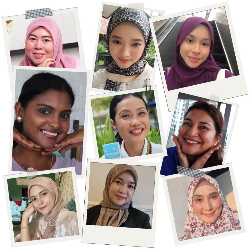 TESTIMONI PENGGUNA YANG DAH BERJAYA HILANGKAN JERAGAT DENGAN MELASMA CARE