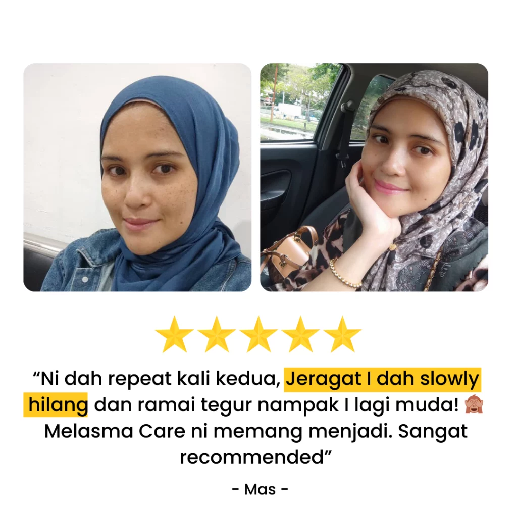 TESTIMONI PENGGUNA YANG DAH BERJAYA HILANGKAN JERAGAT DENGAN MELASMA CARE