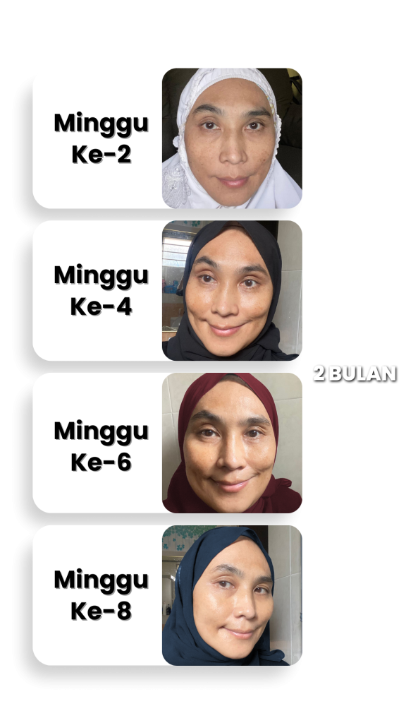 TESTIMONI PENGGUNA YANG DAH BERJAYA HILANGKAN JERAGAT DENGAN MELASMA CARE